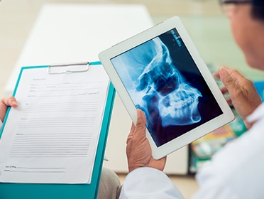 X-ray of jaw and skull